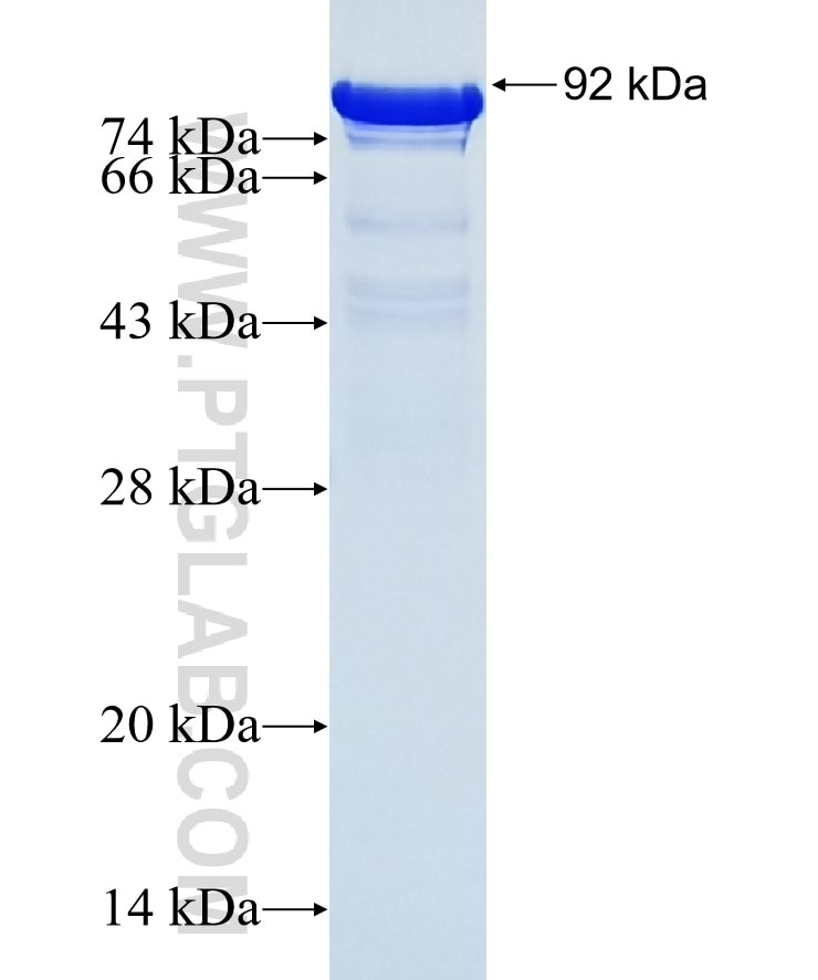 Ubiquilin 2 fusion protein Ag20149 SDS-PAGE