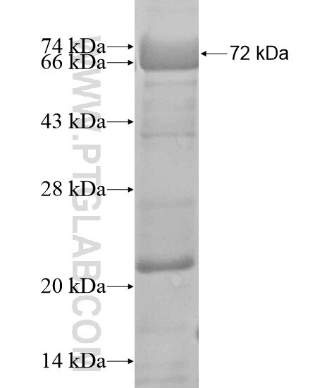 Ubiquilin 2 fusion protein Ag20251 SDS-PAGE