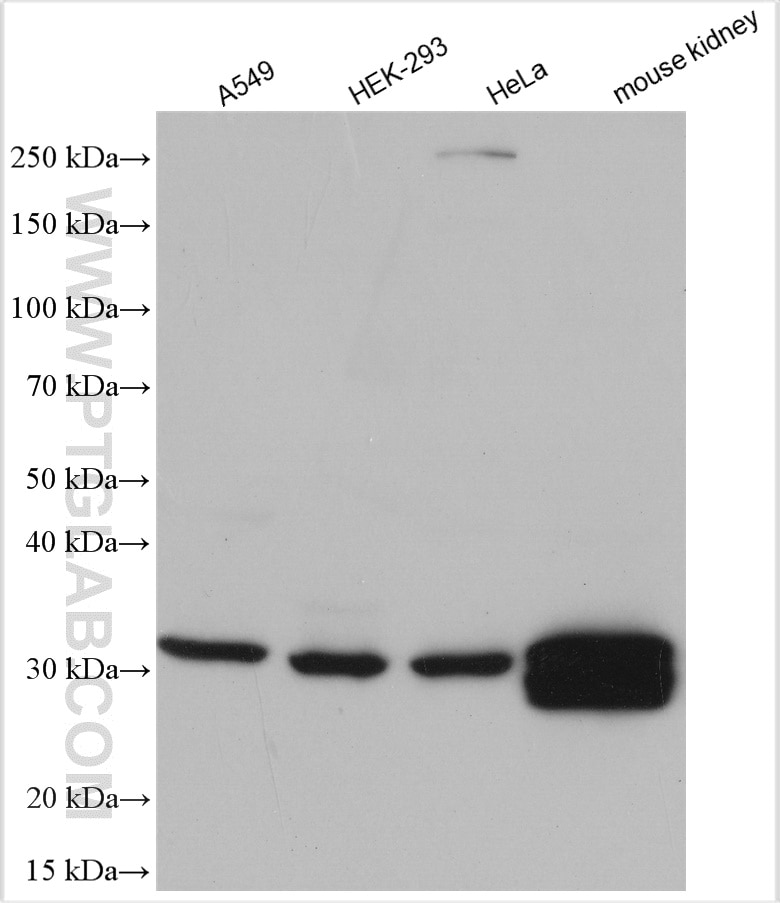 Western Blot (WB) analysis of various lysates using Unc119b Polyclonal antibody (26201-1-AP)