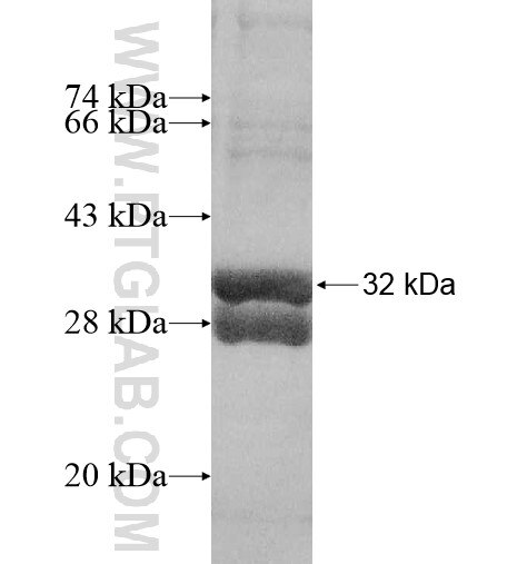 Upk2 fusion protein Ag10378 SDS-PAGE