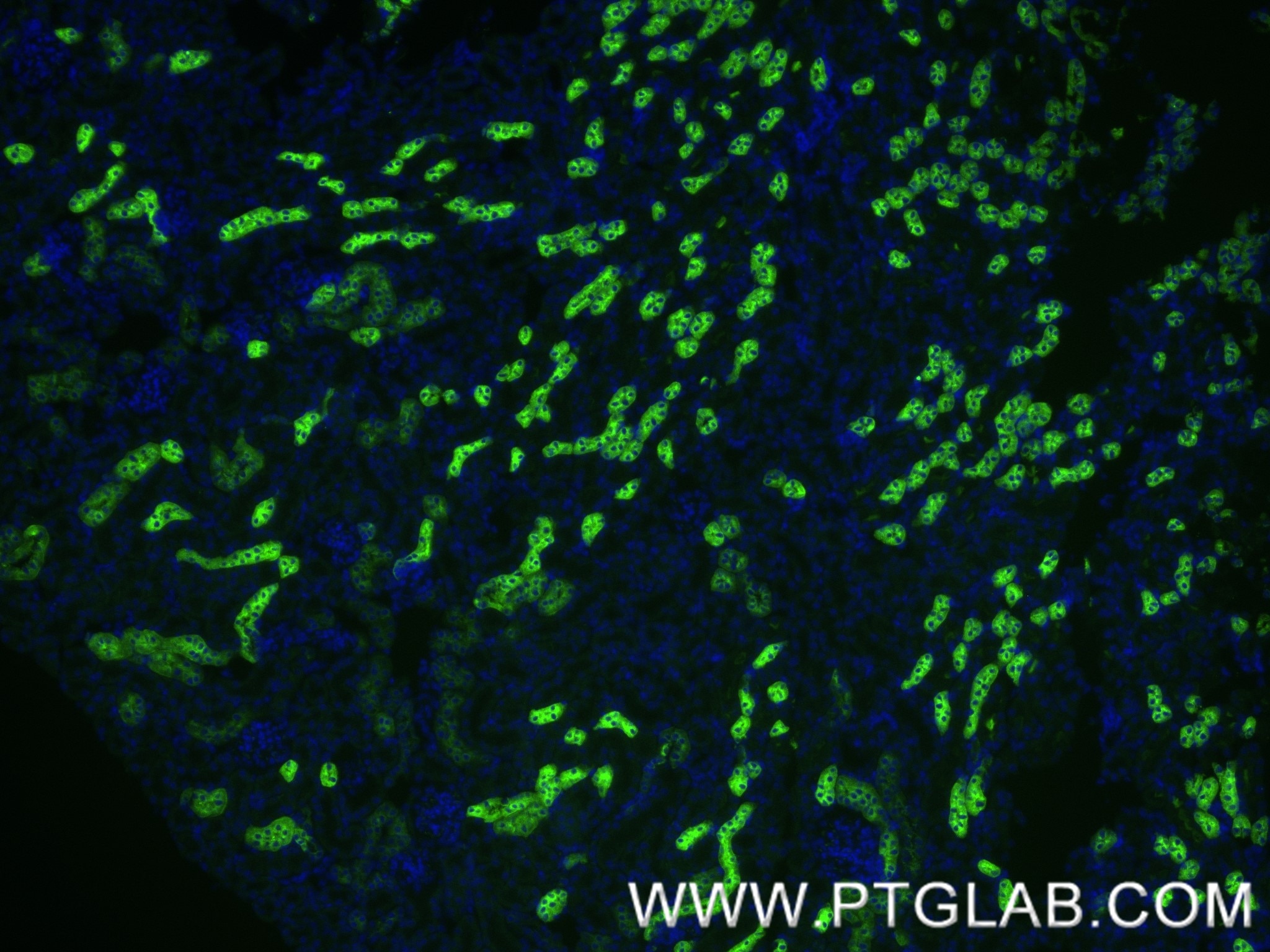 Immunofluorescence (IF) / fluorescent staining of mouse kidney tissue using Uromodulin Recombinant antibody (85597-4-RR)