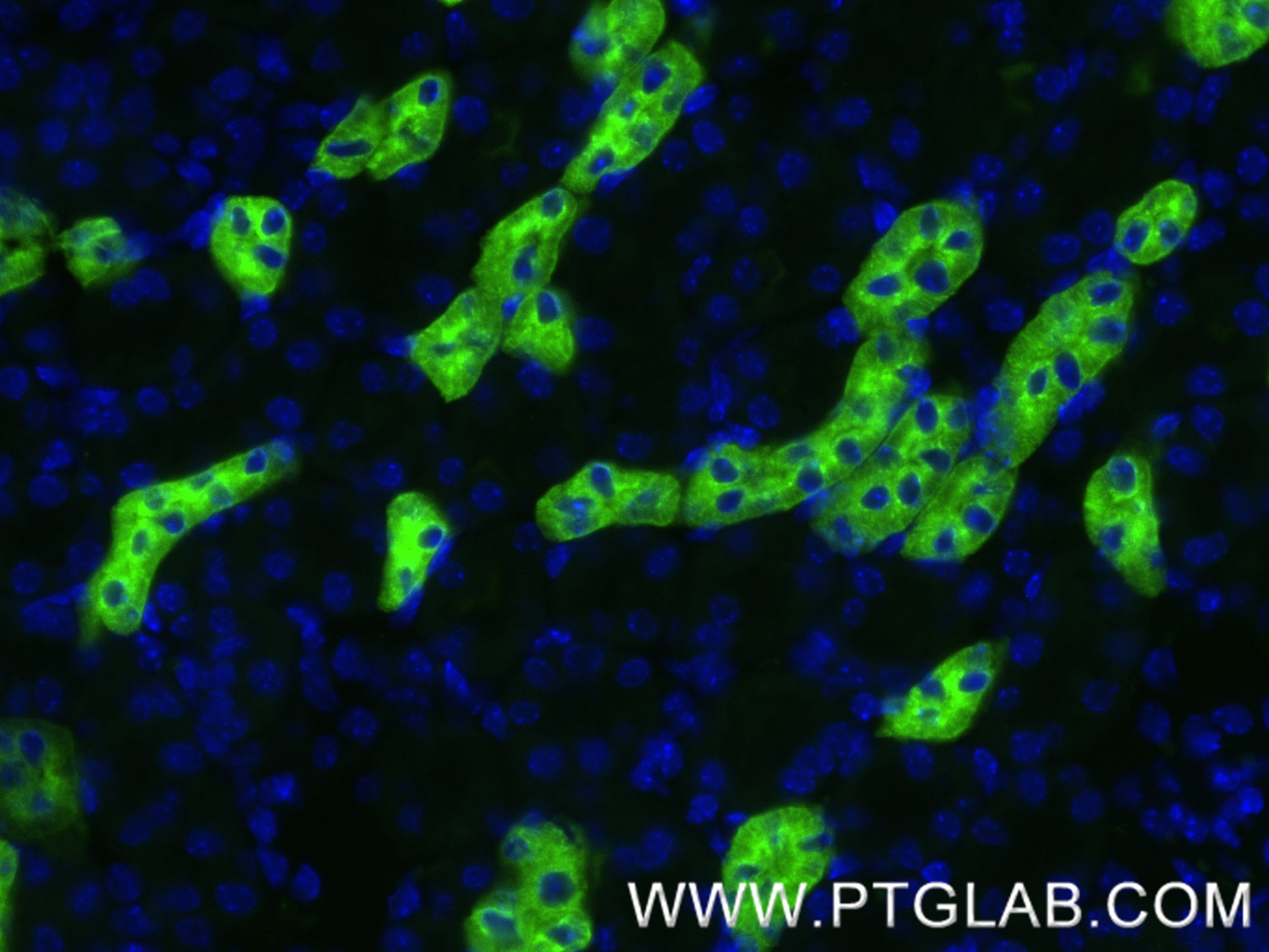 Immunofluorescence (IF) / fluorescent staining of mouse kidney tissue using Uromodulin Recombinant antibody (85597-4-RR)