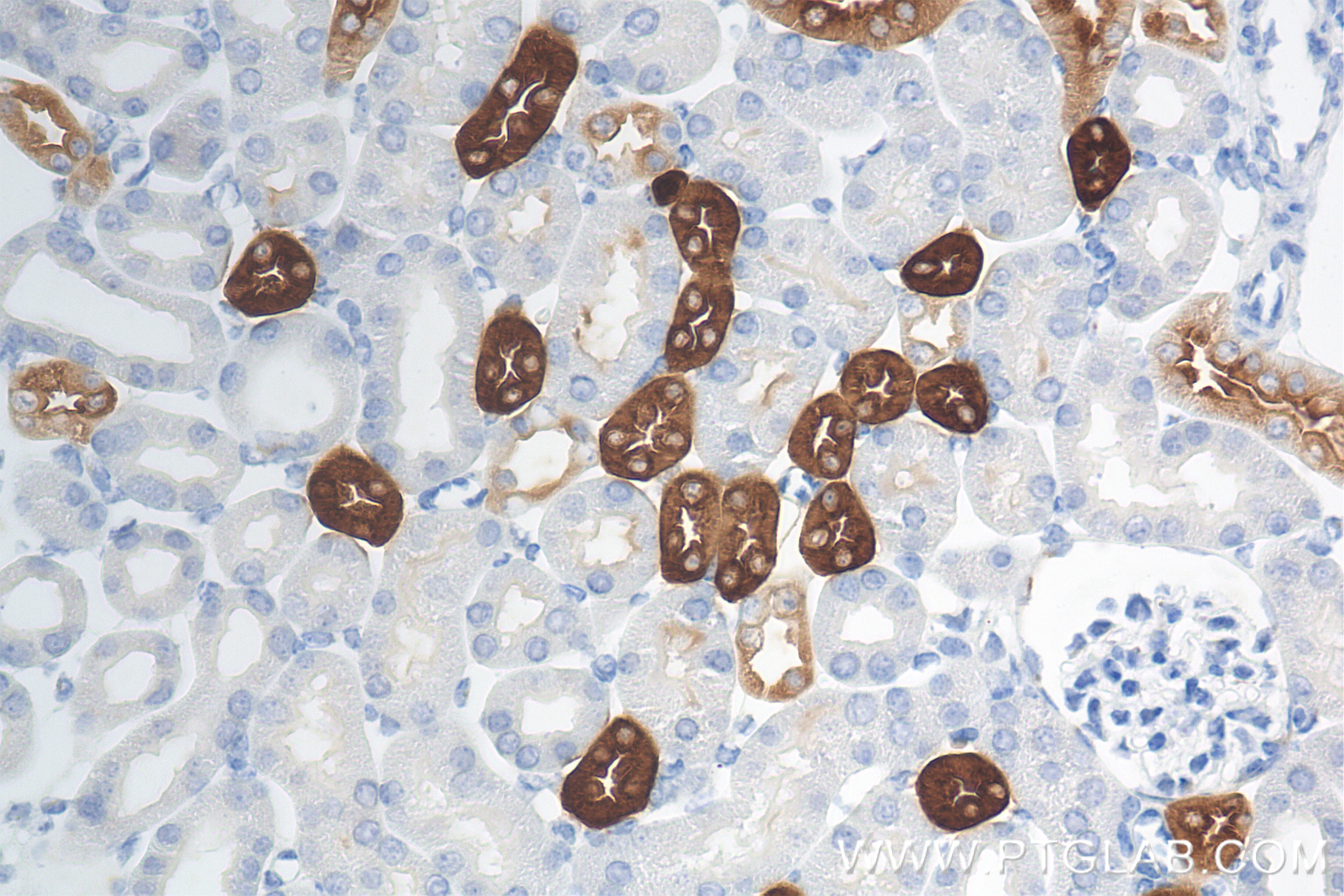 Immunohistochemistry (IHC) staining of mouse kidney tissue using Uromodulin Recombinant antibody (85597-4-RR)