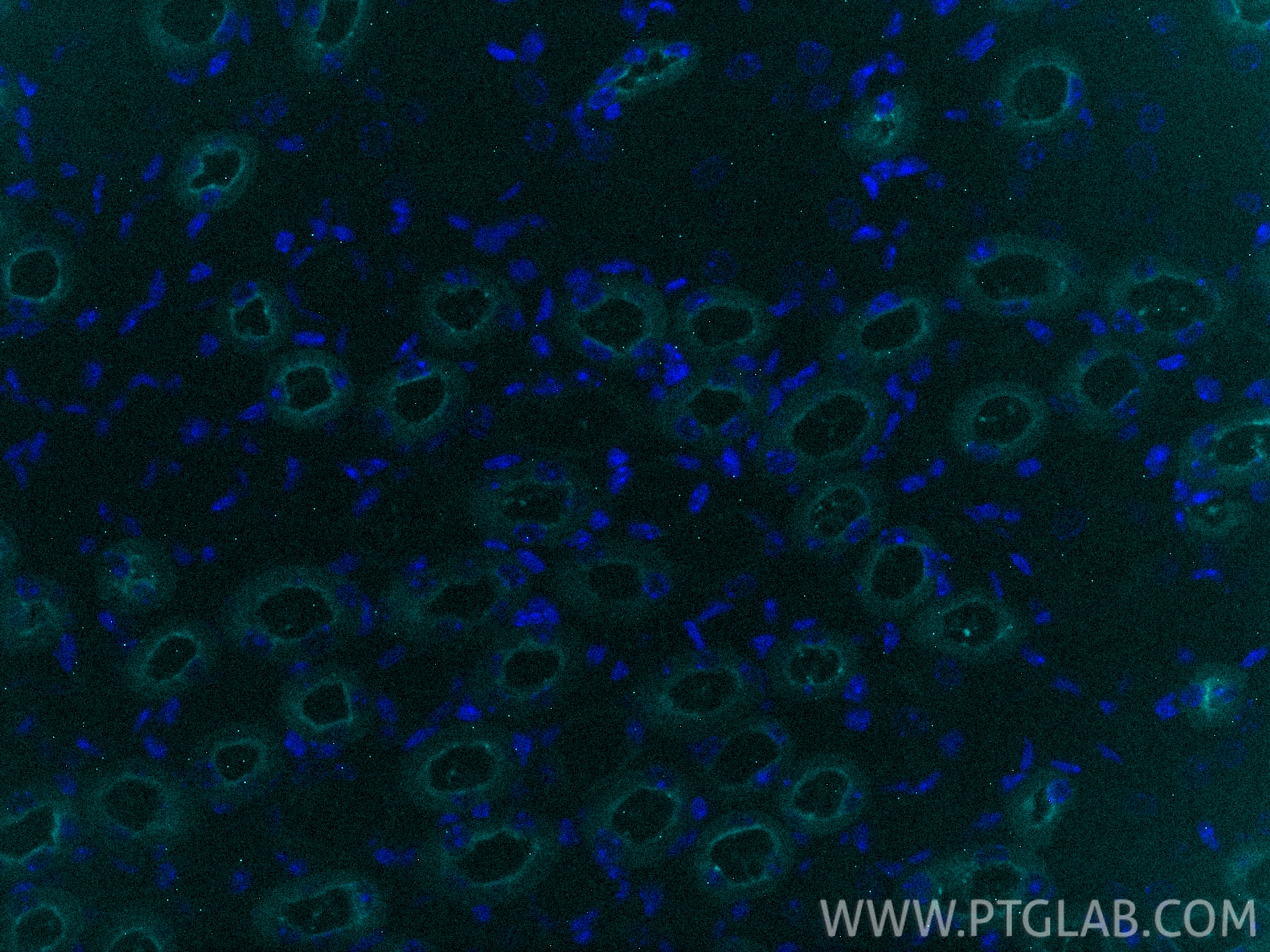 Immunofluorescence (IF) / fluorescent staining of mouse kidney tissue using CoraLite® Plus 750-conjugated Uromodulin Recombina (CL750-85597-4)