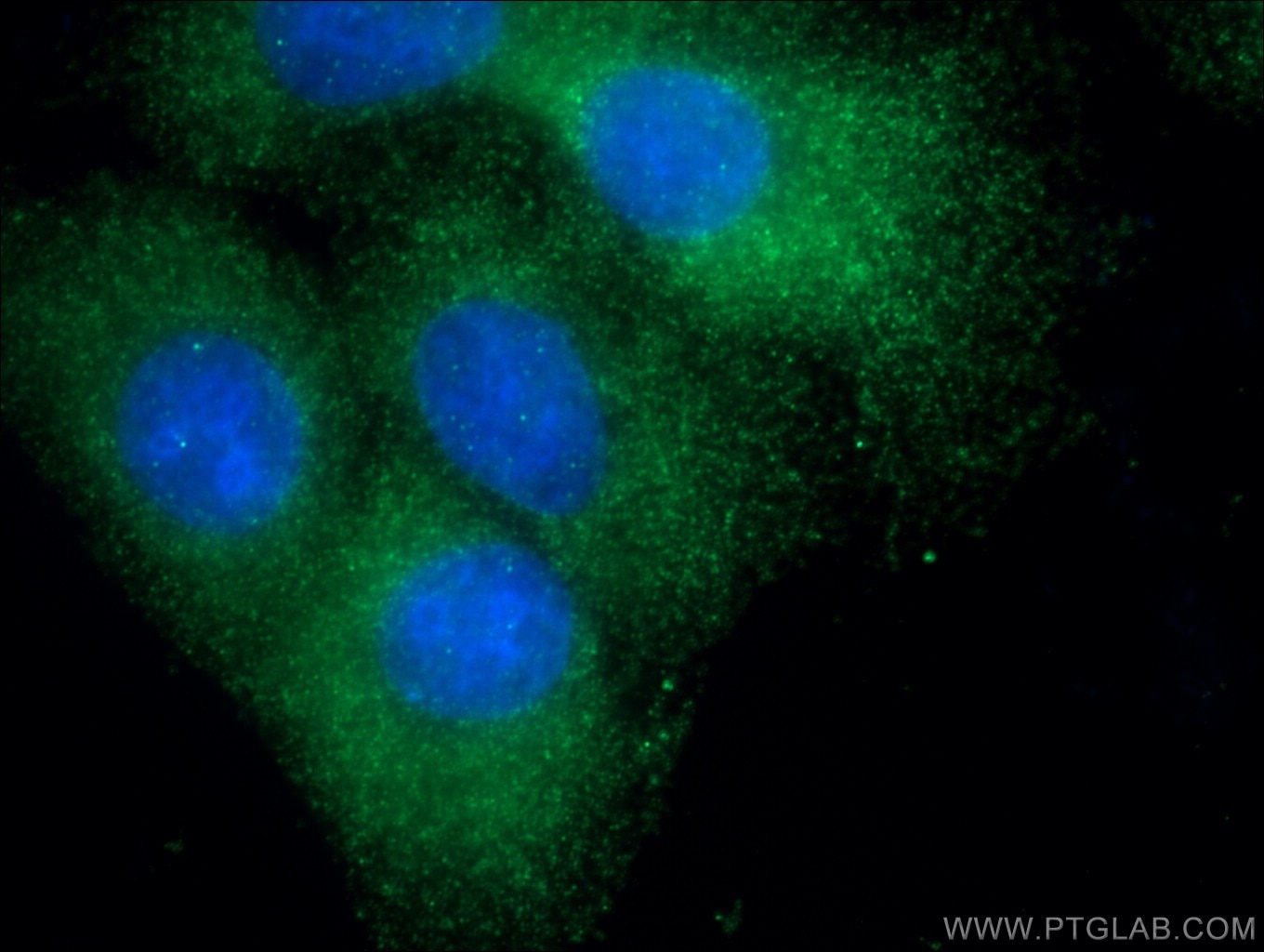 Immunofluorescence (IF) / fluorescent staining of A549 cells using Uteroglobin/CC10 Polyclonal antibody (26909-1-AP)