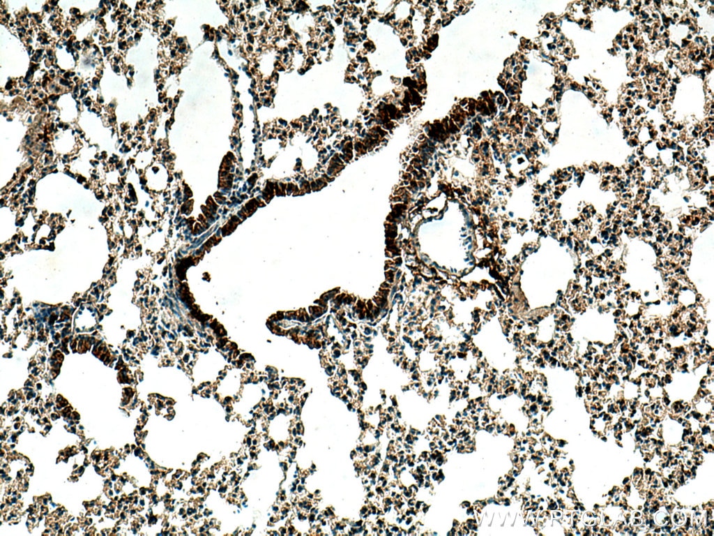 Immunohistochemistry (IHC) staining of mouse lung tissue using Uteroglobin/CC10 Polyclonal antibody (26909-1-AP)