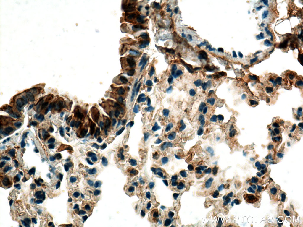 Immunohistochemistry (IHC) staining of mouse lung tissue using Uteroglobin/CC10 Polyclonal antibody (26909-1-AP)