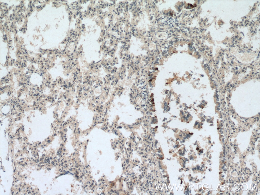 Immunohistochemistry (IHC) staining of human lung tissue using Uteroglobin/CC10 Polyclonal antibody (26909-1-AP)