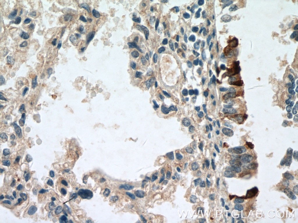 Immunohistochemistry (IHC) staining of human lung tissue using Uteroglobin/CC10 Polyclonal antibody (26909-1-AP)