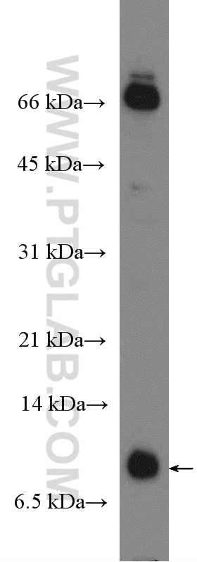 Western Blot (WB) analysis of rat lung tissue using Uteroglobin/CC10 Polyclonal antibody (26909-1-AP)
