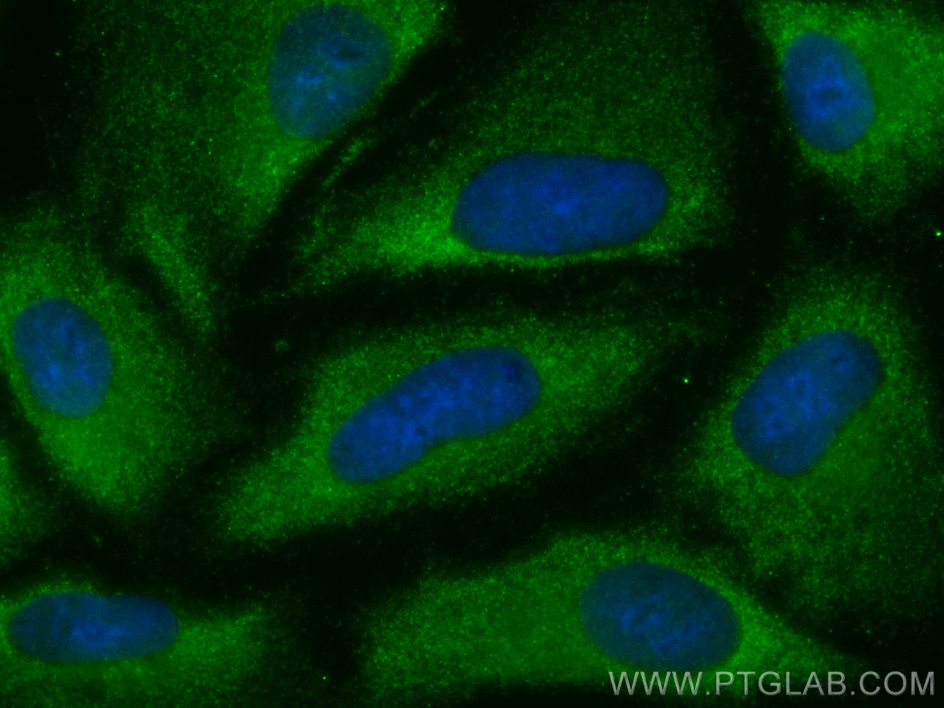 Immunofluorescence (IF) / fluorescent staining of A549 cells using CoraLite® Plus 488-conjugated Uteroglobin/CC10 Pol (CL488-10490)