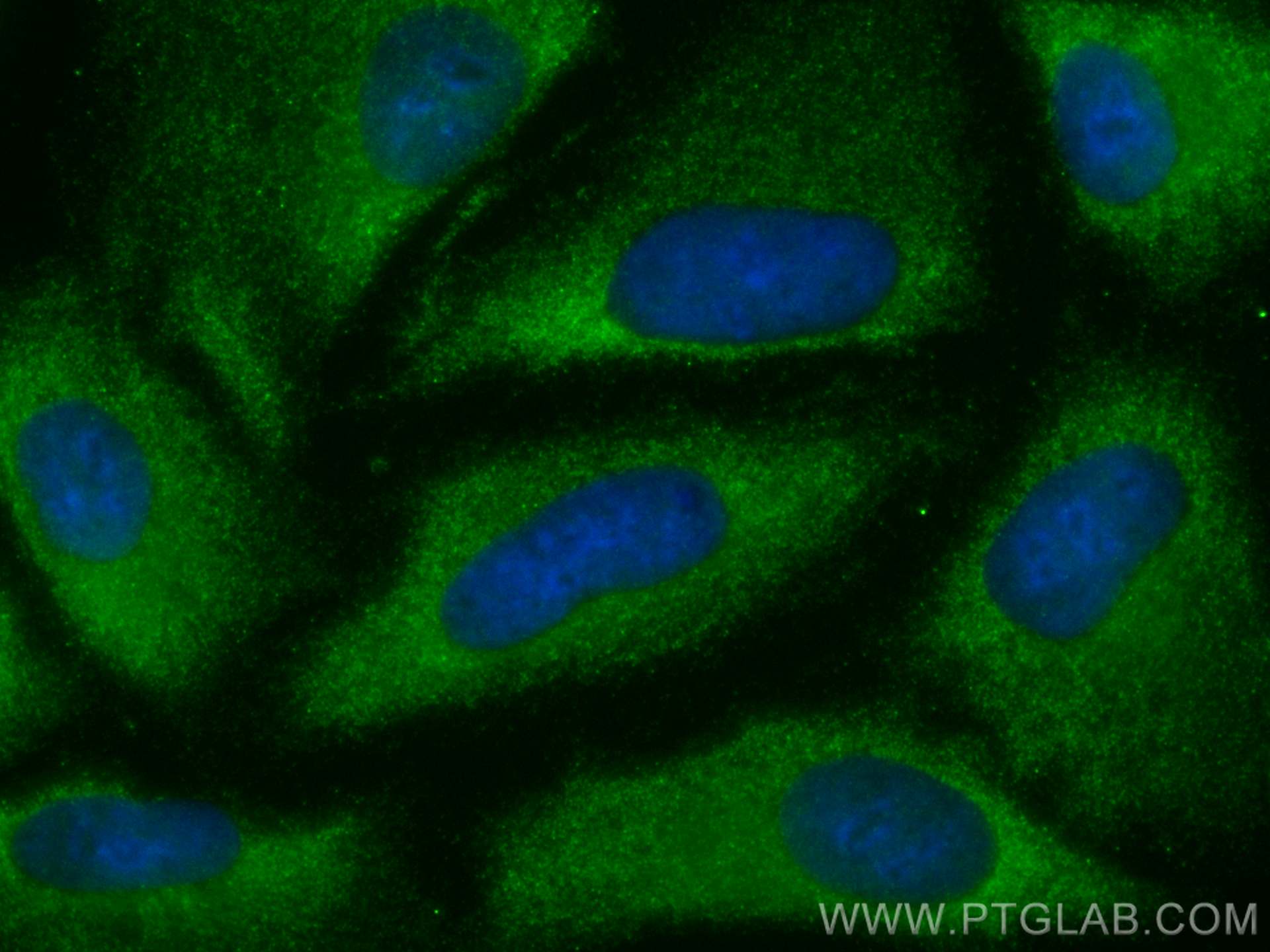 Uteroglobin/CC10