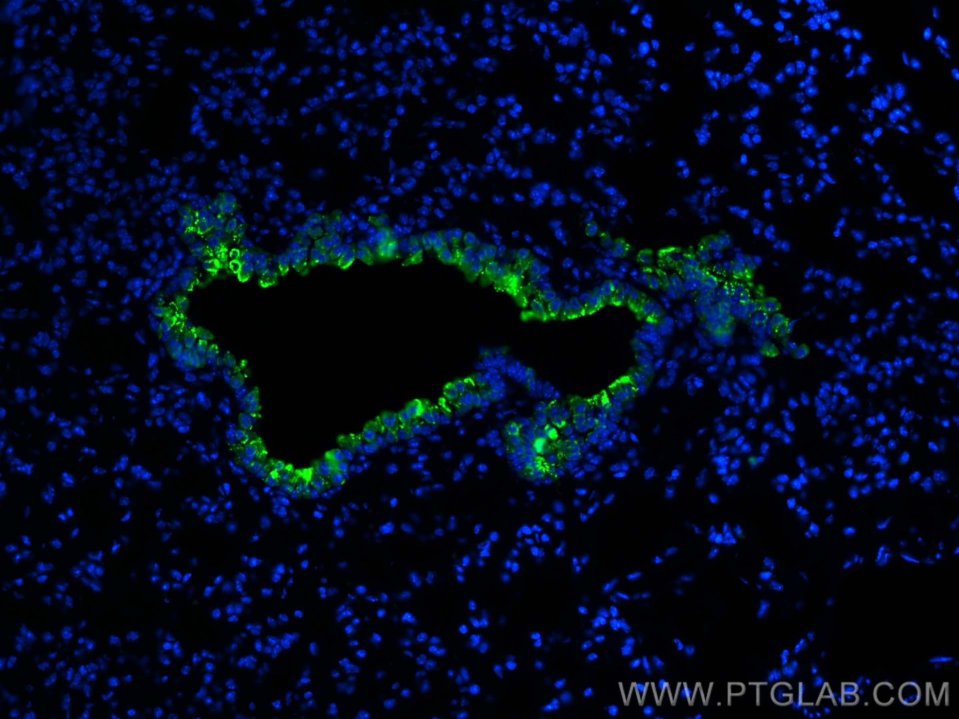Immunofluorescence (IF) / fluorescent staining of mouse lung tissue using CoraLite® Plus 488-conjugated Uteroglobin/CC10 Pol (CL488-10490)