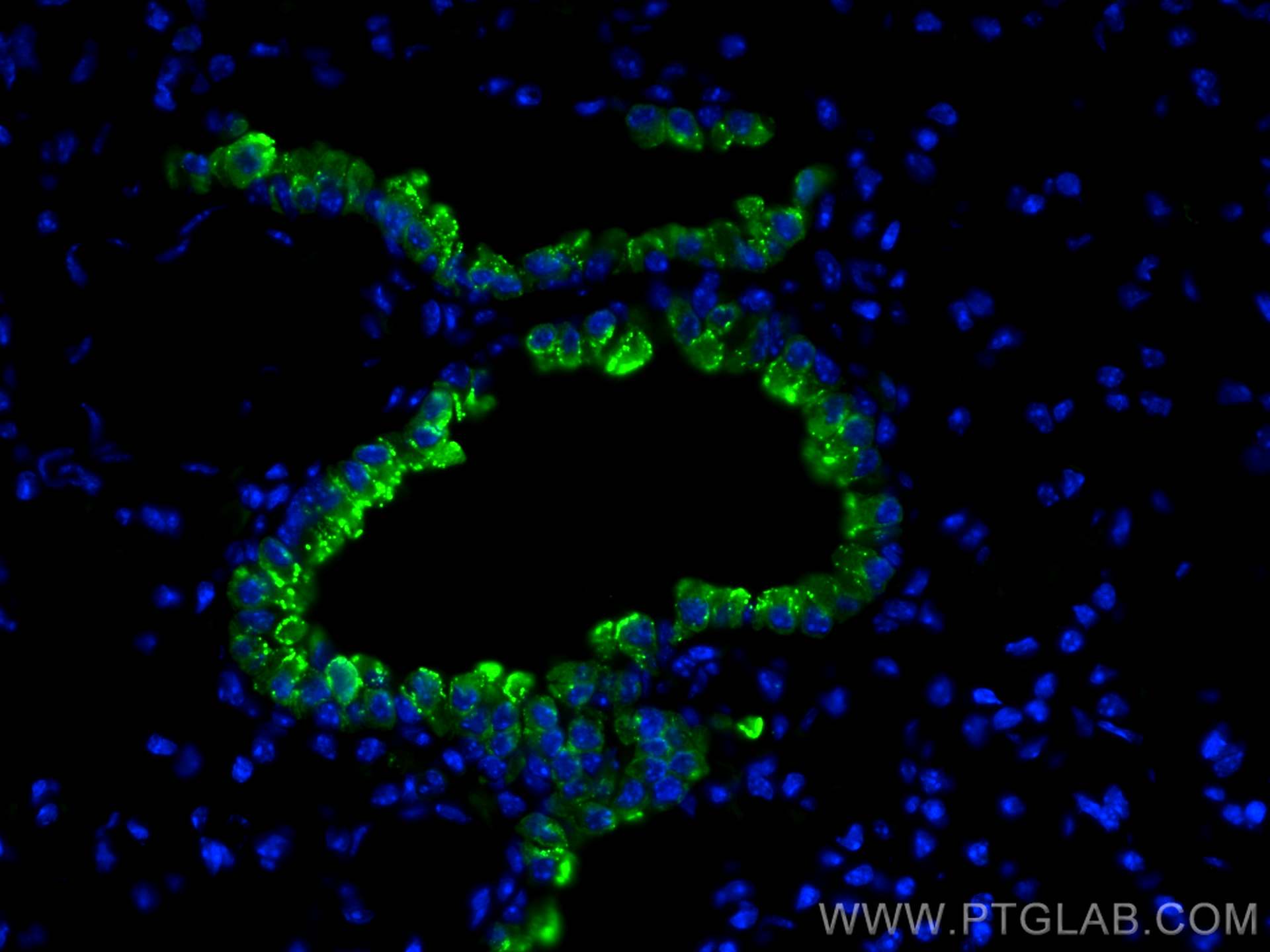 Immunofluorescence (IF) / fluorescent staining of mouse lung tissue using CoraLite® Plus 488-conjugated Uteroglobin/CC10 Pol (CL488-10490)
