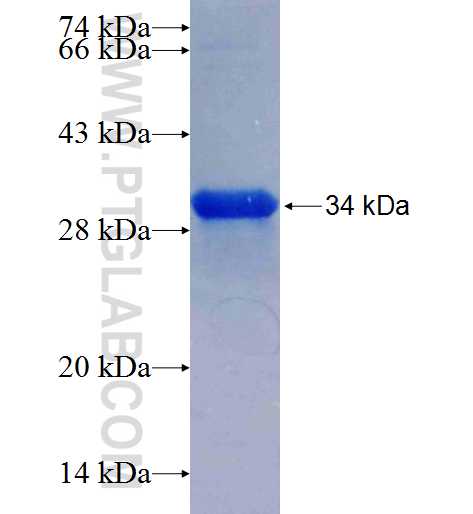 Uteroglobin fusion protein Ag25530 SDS-PAGE