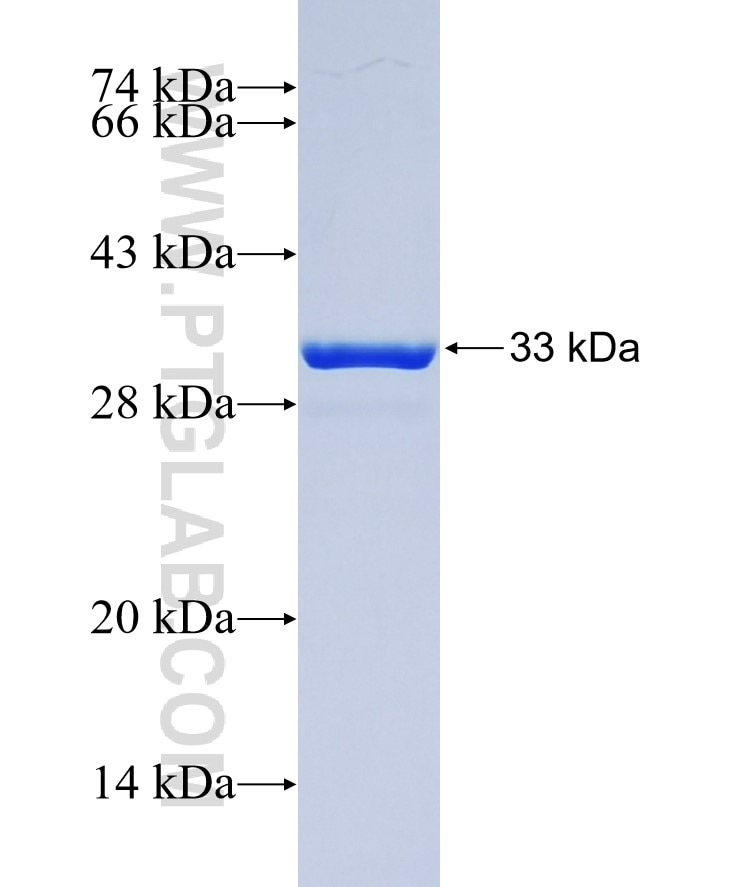 Uteroglobin fusion protein Ag0758 SDS-PAGE