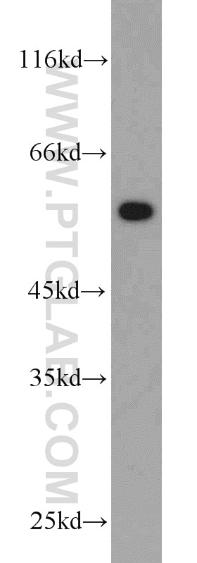 Western Blot (WB) analysis of Recombinant protein using V5-tag Polyclonal antibody (14440-1-AP)