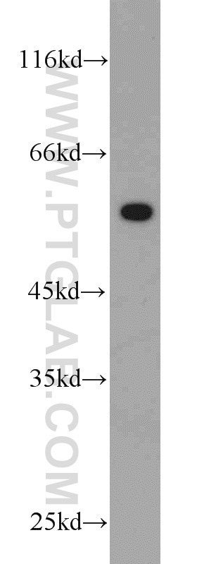 Western Blot (WB) analysis of Recombinant protein using V5-tag Polyclonal antibody (14440-1-AP)