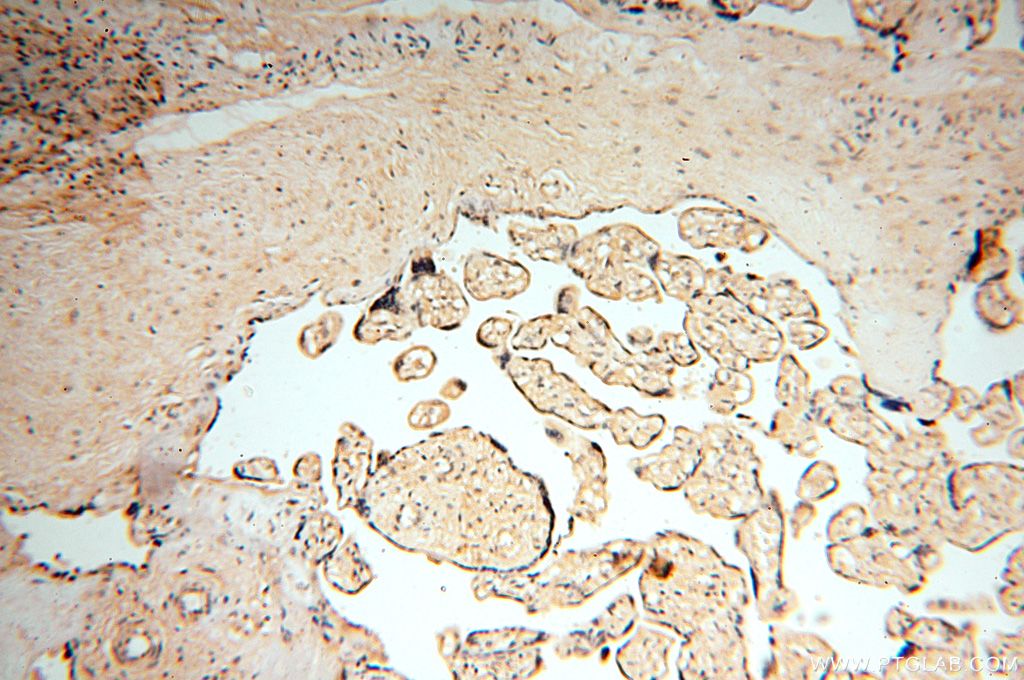 Immunohistochemistry (IHC) staining of human placenta tissue using VAC14 Polyclonal antibody (15771-1-AP)