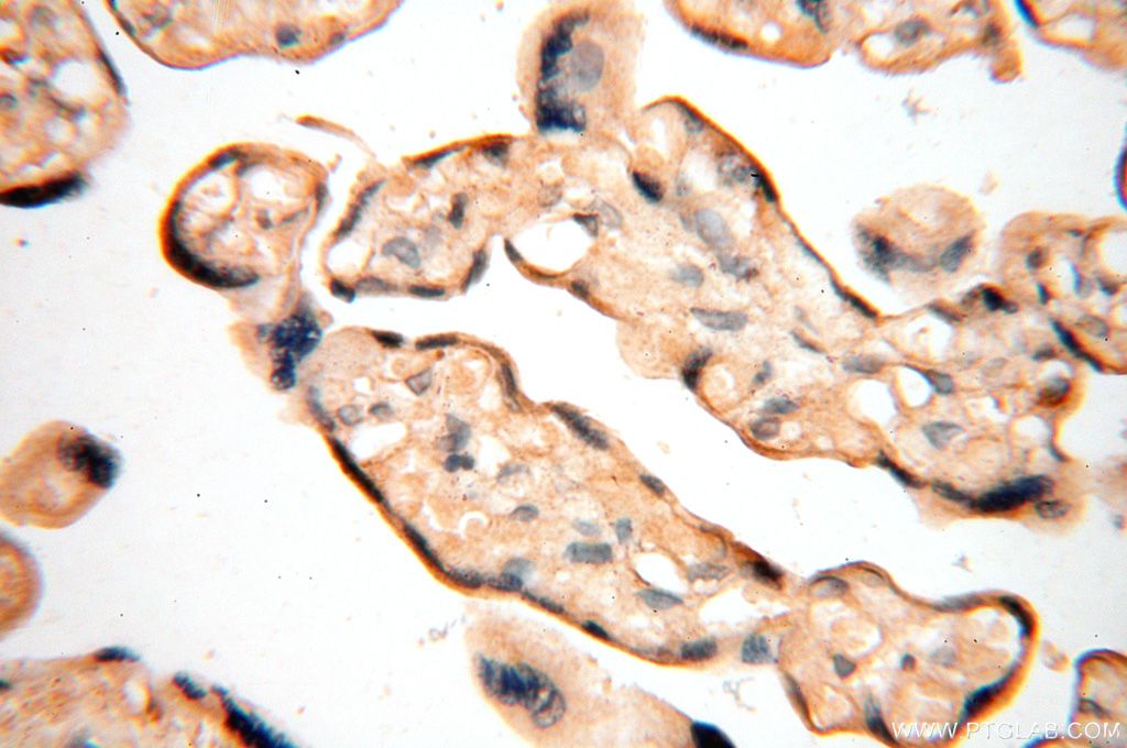 Immunohistochemistry (IHC) staining of human placenta tissue using VAC14 Polyclonal antibody (15771-1-AP)