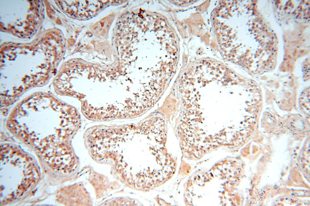 Immunohistochemistry (IHC) staining of human testis tissue using VAC14 Polyclonal antibody (15771-1-AP)