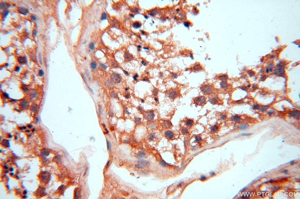 Immunohistochemistry (IHC) staining of human testis tissue using VAC14 Polyclonal antibody (15771-1-AP)