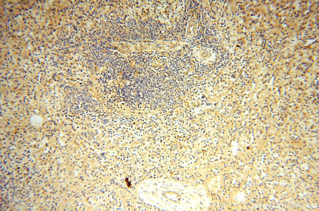 Immunohistochemistry (IHC) staining of human spleen tissue using VAC14 Polyclonal antibody (15771-1-AP)