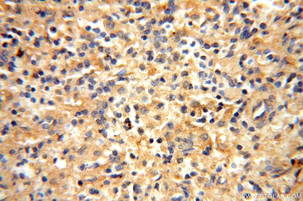 Immunohistochemistry (IHC) staining of human spleen tissue using VAC14 Polyclonal antibody (15771-1-AP)