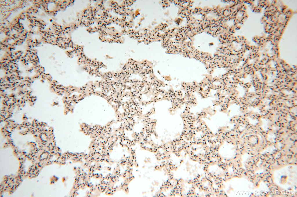 Immunohistochemistry (IHC) staining of human lung tissue using VAC14 Polyclonal antibody (15771-1-AP)