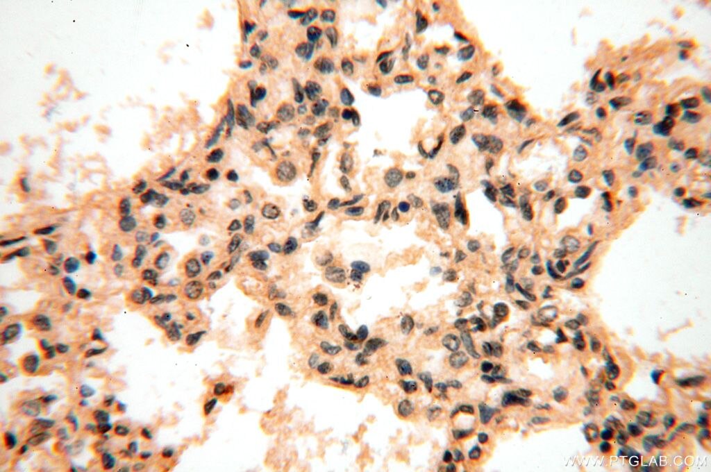 Immunohistochemistry (IHC) staining of human lung tissue using VAC14 Polyclonal antibody (15771-1-AP)