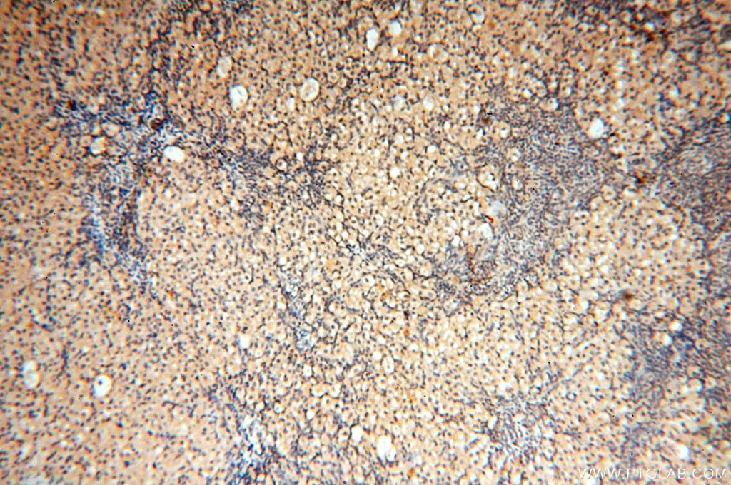 Immunohistochemistry (IHC) staining of human ovary tissue using VAC14 Polyclonal antibody (15771-1-AP)