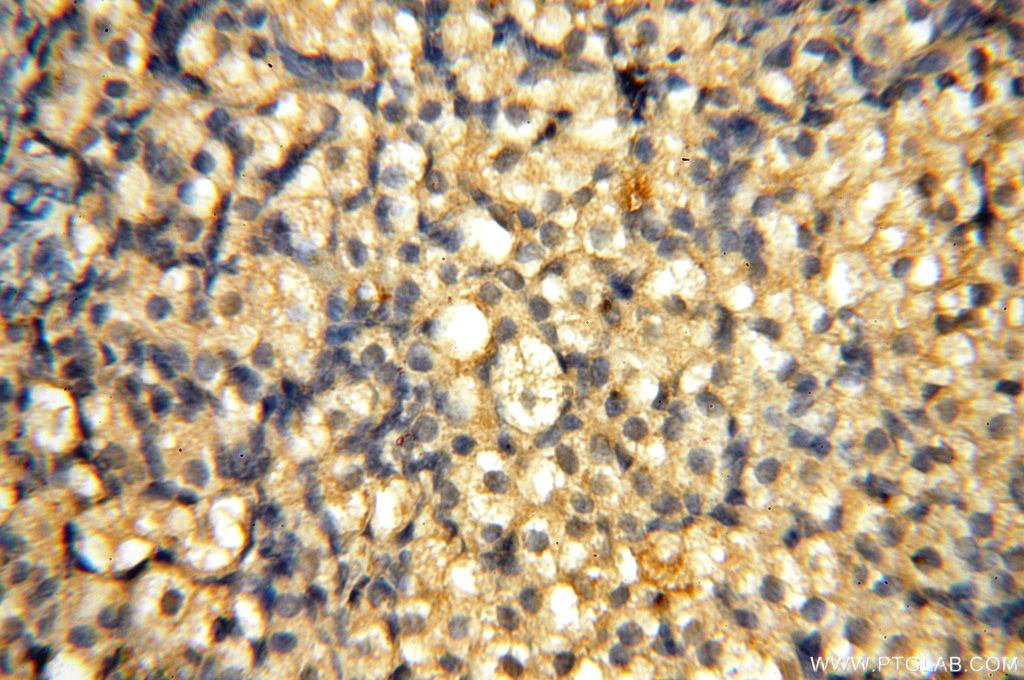 Immunohistochemistry (IHC) staining of human ovary tissue using VAC14 Polyclonal antibody (15771-1-AP)