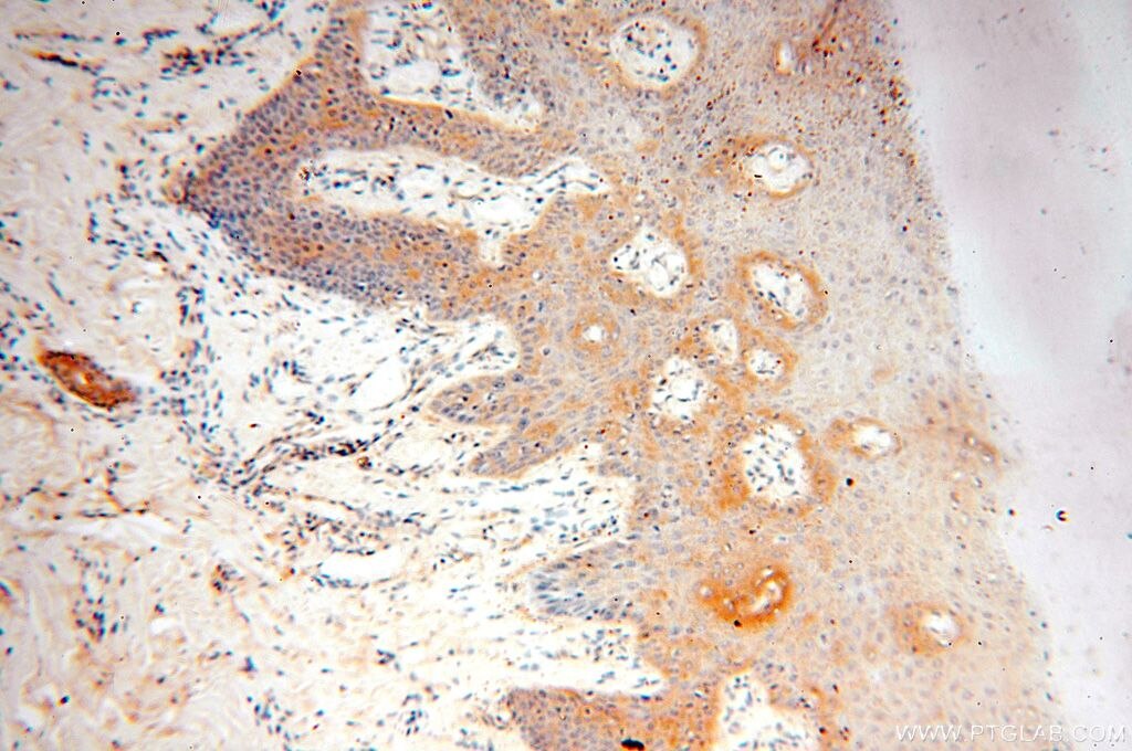 Immunohistochemistry (IHC) staining of human skin tissue using VAC14 Polyclonal antibody (15771-1-AP)