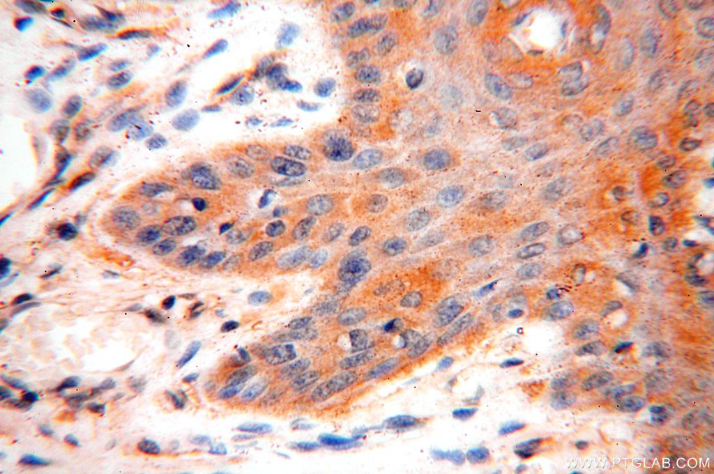 Immunohistochemistry (IHC) staining of human skin tissue using VAC14 Polyclonal antibody (15771-1-AP)