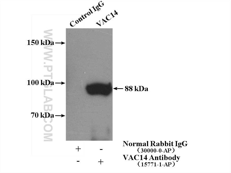 Immunoprecipitation (IP) experiment of Jurkat cells using VAC14 Polyclonal antibody (15771-1-AP)