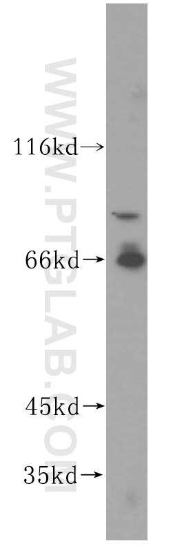 Western Blot (WB) analysis of Jurkat cells using VAC14 Polyclonal antibody (15771-1-AP)