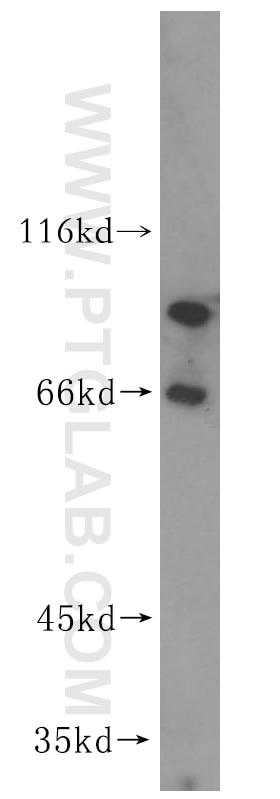 Western Blot (WB) analysis of human spleen tissue using VAC14 Polyclonal antibody (15771-1-AP)