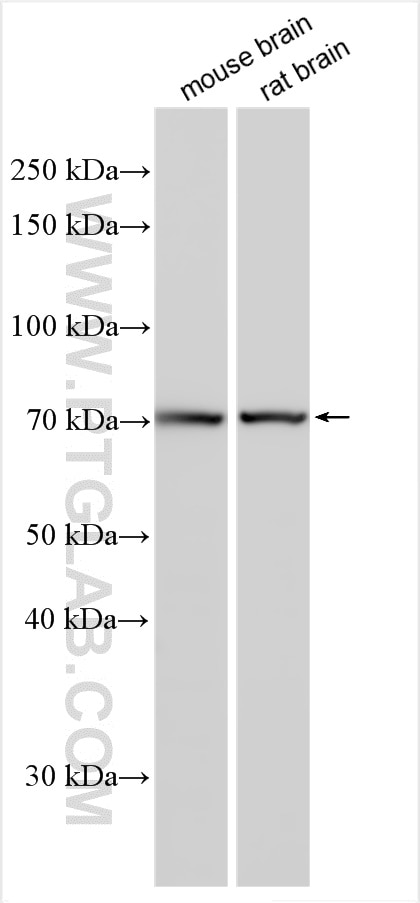 Western Blot (WB) analysis of various lysates using VAChT Polyclonal antibody (27303-1-AP)