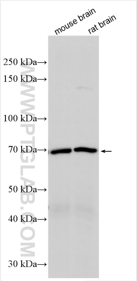 Western Blot (WB) analysis of various lysates using VAChT Polyclonal antibody (27303-1-AP)