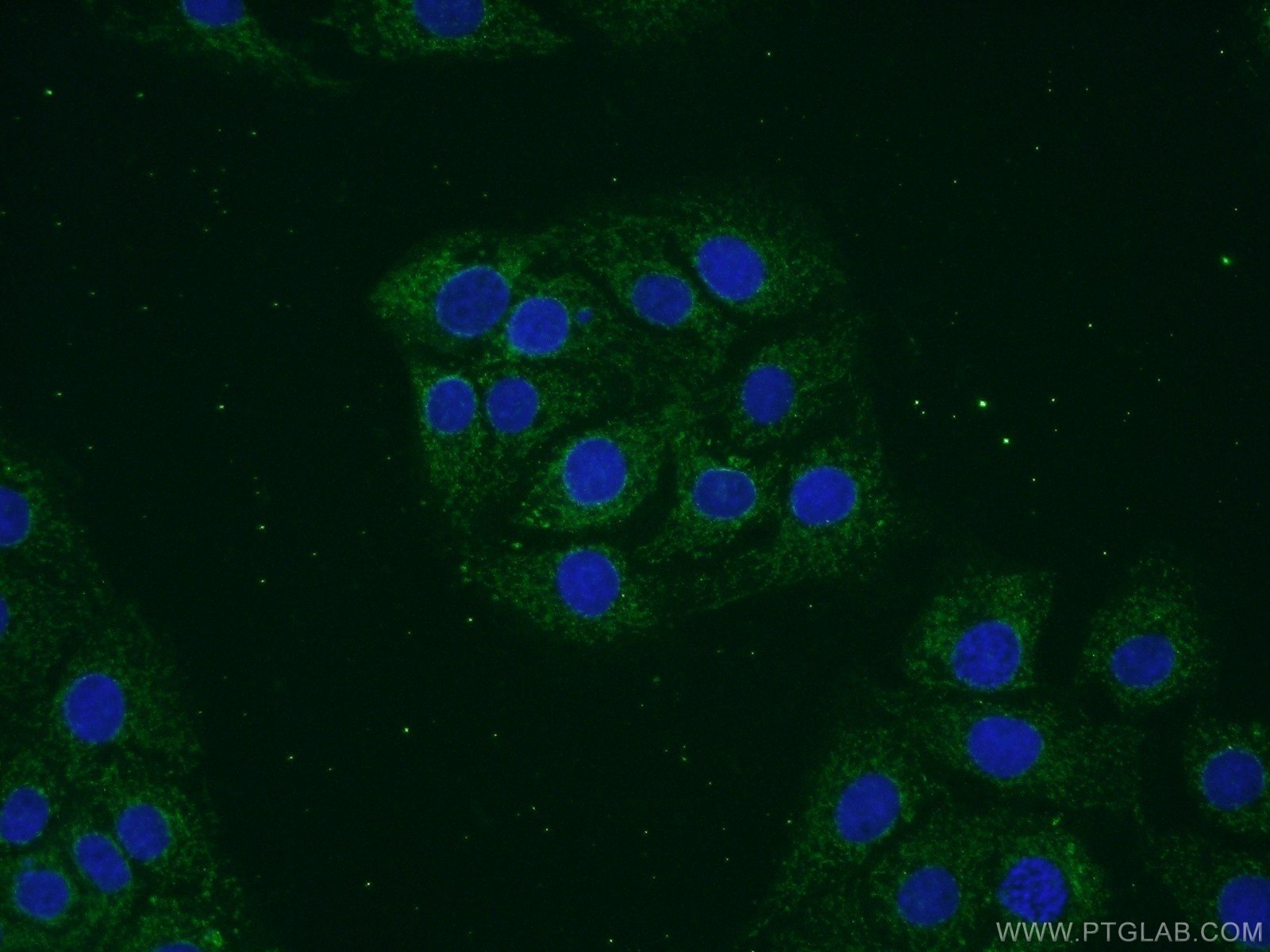 Immunofluorescence (IF) / fluorescent staining of SH-SY5Y cells using VAMP1 Polyclonal antibody (13115-1-AP)