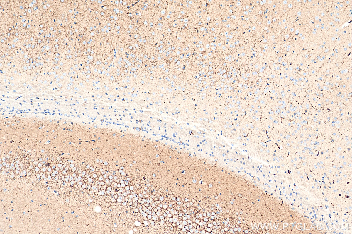 Immunohistochemistry (IHC) staining of mouse brain tissue using VAMP1 Polyclonal antibody (13115-1-AP)