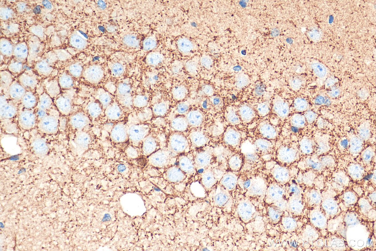 Immunohistochemistry (IHC) staining of mouse brain tissue using VAMP1 Polyclonal antibody (13115-1-AP)