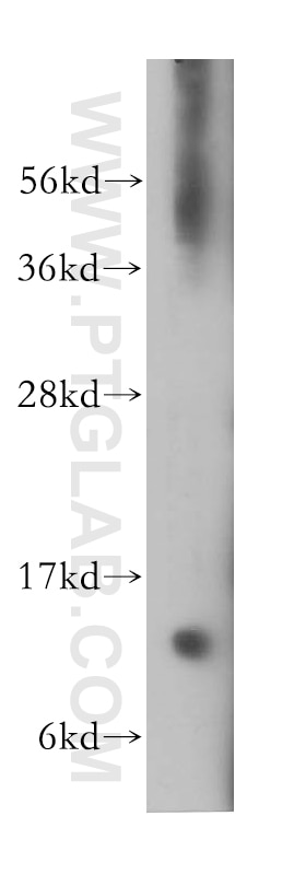 Western Blot (WB) analysis of human brain tissue using VAMP1 Polyclonal antibody (13115-1-AP)