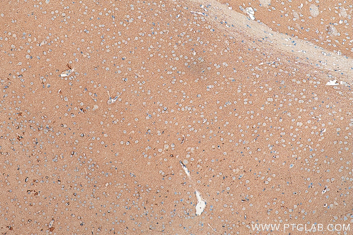 Immunohistochemistry (IHC) staining of mouse brain tissue using VAMP2 Polyclonal antibody (10135-1-AP)