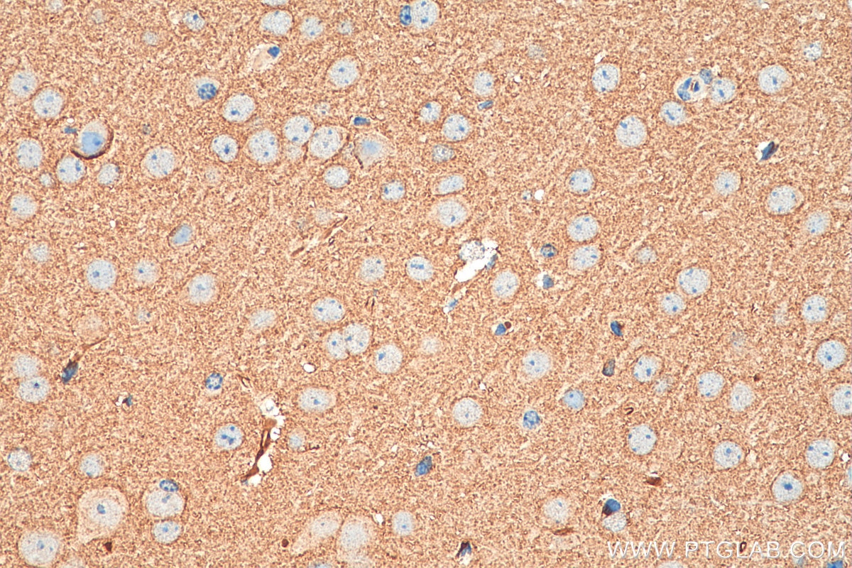 Immunohistochemistry (IHC) staining of mouse brain tissue using VAMP2 Polyclonal antibody (10135-1-AP)