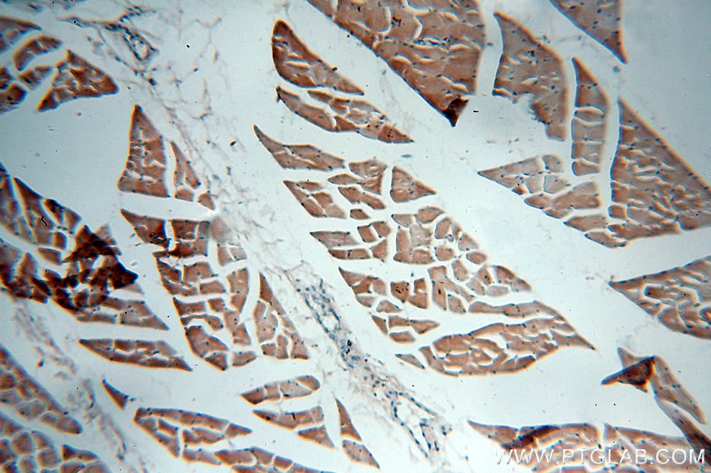 Immunohistochemistry (IHC) staining of human skeletal muscle tissue using VAMP2 Polyclonal antibody (10135-1-AP)