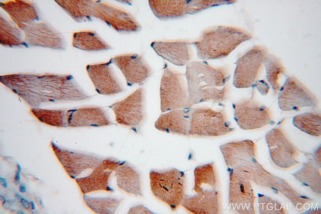 Immunohistochemistry (IHC) staining of human skeletal muscle tissue using VAMP2 Polyclonal antibody (10135-1-AP)
