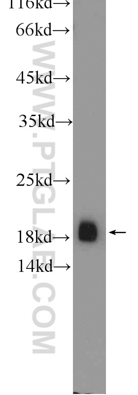 VAMP2 Polyclonal antibody