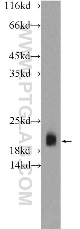 Western Blot (WB) analysis of fetal human brain tissue using VAMP2 Polyclonal antibody (10135-1-AP)