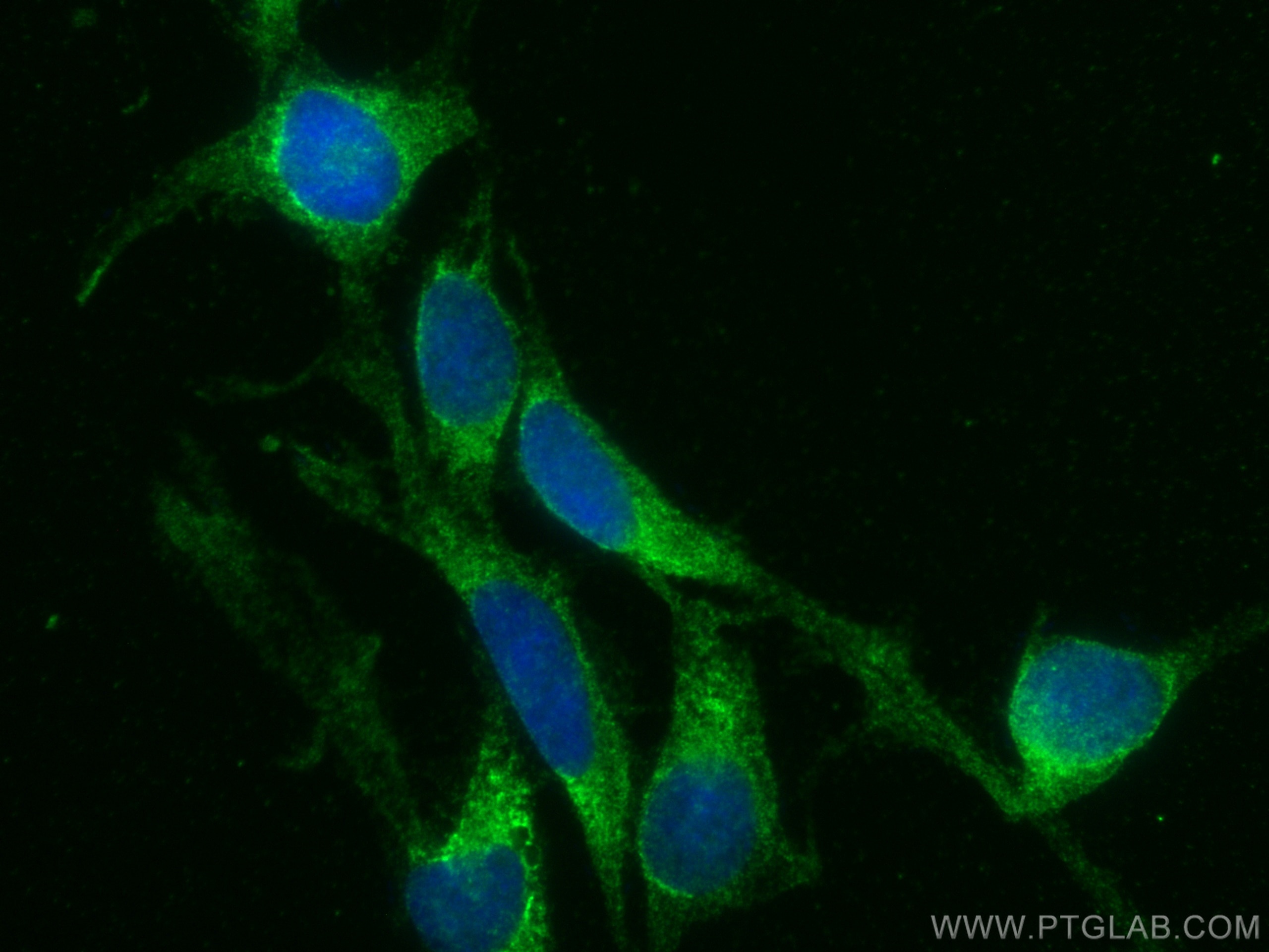 Immunofluorescence (IF) / fluorescent staining of SH-SY5Y cells using VAMP2 Monoclonal antibody (67822-1-Ig)